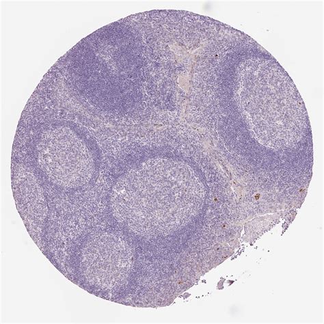 Tissue Expression Of Dhrs11 Staining In Tonsil The Human Protein Atlas