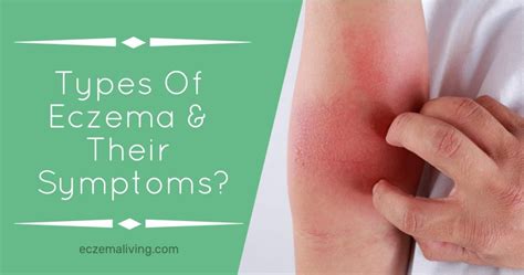 What Are The Various Types Of Eczema And Their Symptoms