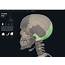 Bones Skull Occipital – Anatomy & Physiology
