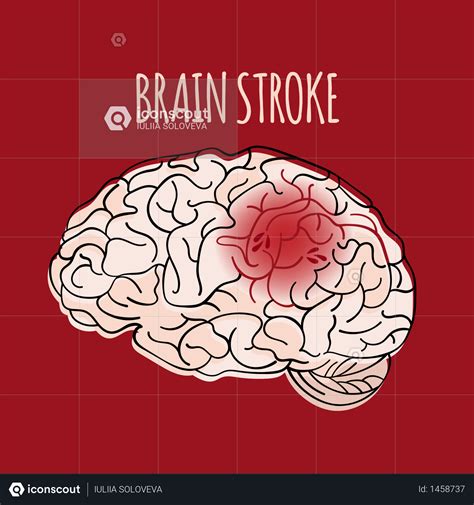 Best Premium Brain Stroke Illustration Download In Png And Vector Format