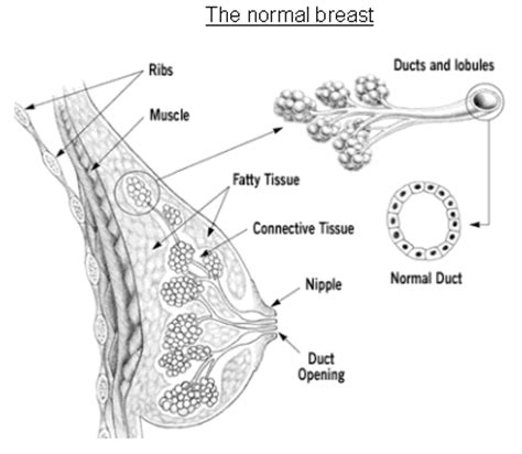 If you have symptoms, see your doctor without delay. Breast Cancer - symptoms, diagnosis, treatment | Southern ...