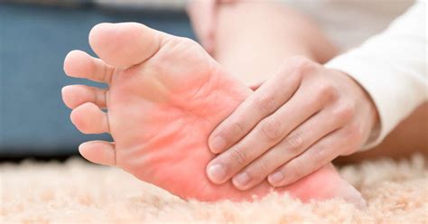 Psoriatic Arthritis How Does It Affect The Feet