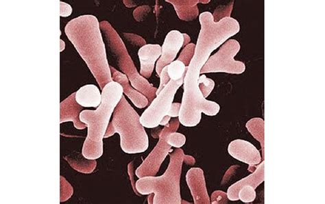 Bifidobacterium Spp Gotochef