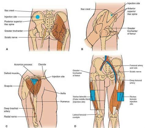 When you inject into the arm (deltoid) your main goal will be to penetrate the muscle and then slowly deliver the vitamin b12 into the muscle, and then extract the needle at the same 90 degree angle that you inserted it. The 25+ best Im injection sites ideas on Pinterest | Rn ...