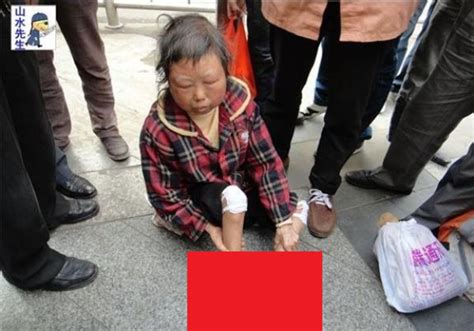 B 閲覧注意中国で話題路上で助けを求める足がミイラ化した 歳の女性 ポッカキット