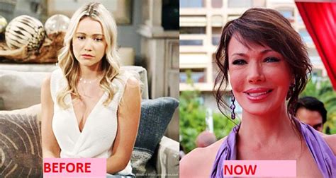 hunter tylo s plastic surgery she looks completely different