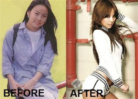 Lee Hyori Plastic Surgery Before And After CELEB SURGERY COM