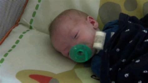 Adorable Baby Born Without A Nose Kabc7 Photos And Slideshows Abc7
