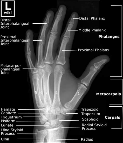 Hand Radiographic Anatomy Wikiradiography