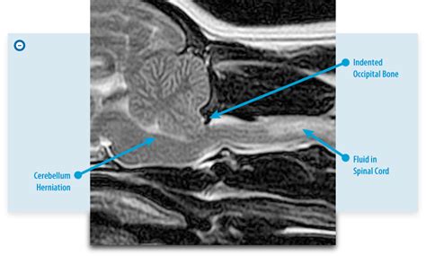 Syringomyelia Screening | Bush Advanced Veterinary Imaging