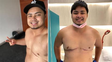 former pbb housemate jesi corcuera proudly shows his surgery scars as a transman push ph