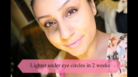 What To Use To Lighten Under Eyes Resipes My Familly