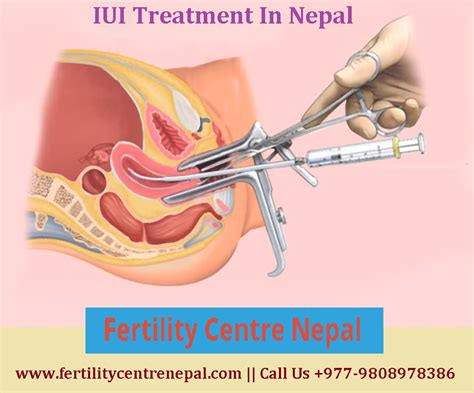 In The Quest For The Best Fertility Centre For IUI Treatment In Nepal
