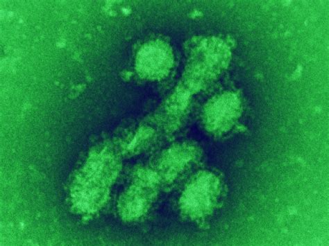 H1n1 Flu Same Strain In Canada And Mexico Ctv News