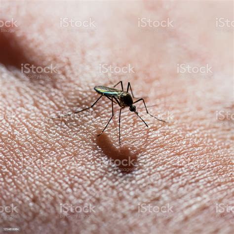 Dangerous Zika Infected Mosquito Bite Leishmaniasis Encephalitis Yellow