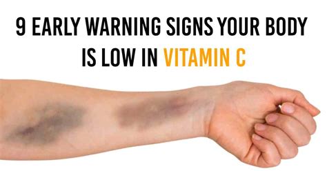 9 Early Warning Signs Youre Running Low On Vitamin C