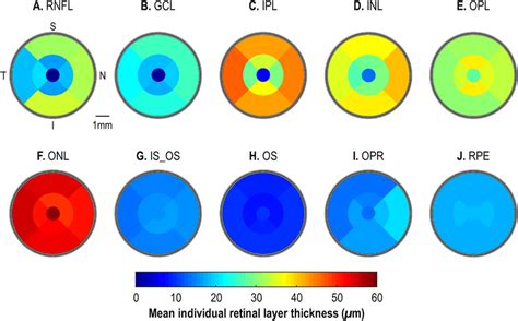 Etdrs Color Map Summarizing The Mean Individual 10 Retinal Layer