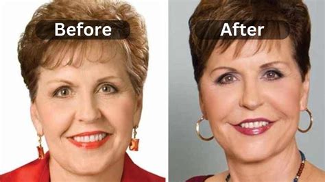 Joyce Meyer S Plastic Surgery Journey Before After Weight Loss