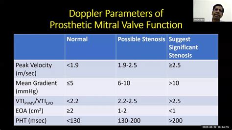 Philips Echo Webinar Series Evaluation Of Prosthetic Mitral Valve By