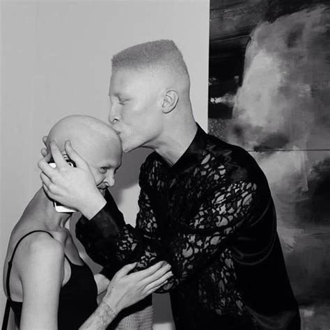 Shaun Ross Melanie Gaydos A Model Who Was Born With A Rare Genetic Disorder Called Ectodermal