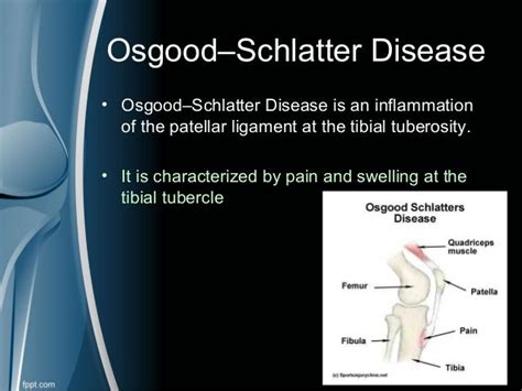 Osgoodschlatter Disease
