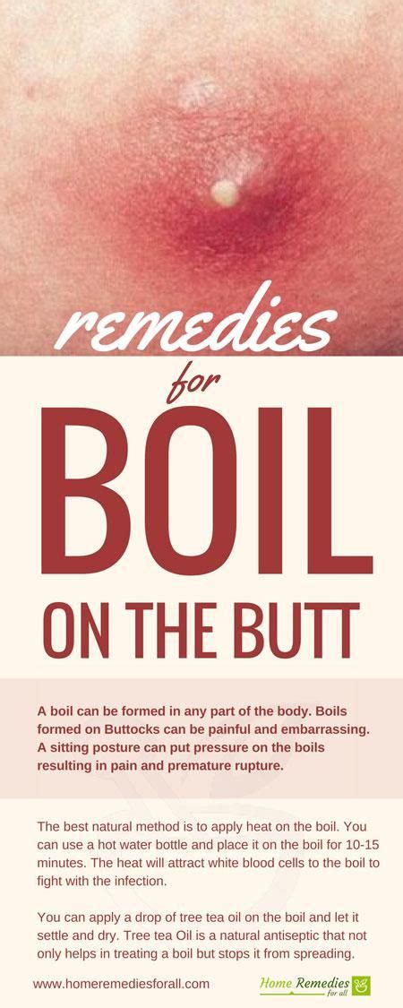 9 Boils Remedies Ideas Boil Remedies Remedies Boil