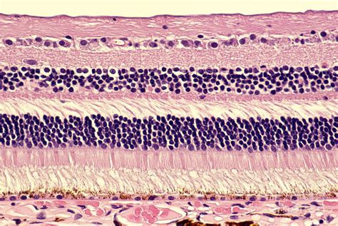 Histology Of Normal Retina Photograph By Ralph C Eagle Jr Pixels