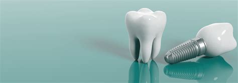 If you get dental implants, you can expect to spend $3,000 to $5,000 per tooth. Dental Implants in Canary Wharf, DOCKLANDS, LONDON, E14.