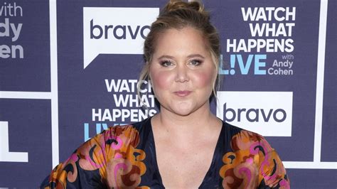 Amy Schumer Says Rare Cushing Syndrome Is Behind Puffier Face