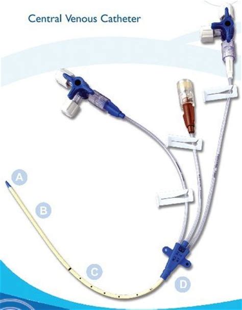 Multi Lumen Central Venous Catheter At Rs 895pack Central Venous