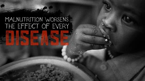 Disease Malnutrition Worsens The Effect