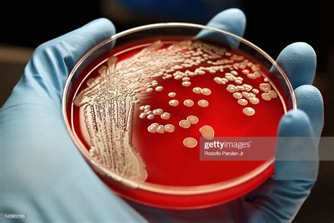 Mrsa Colonies On Blood Agar Plate High Res Stock Photo Getty Images
