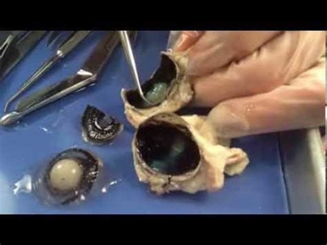 Prof. Wilson sheep eye dissection. The best sheep eye dissection - YouTube