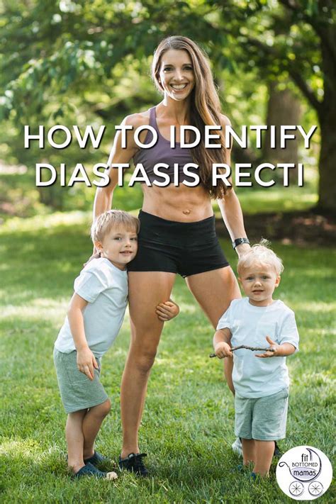 Diastasis Recti How To Identify Abdominal Separation After Pregnancy