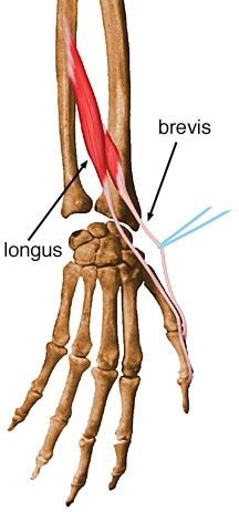 Extensor Pollicis Longus - Anatomy - Orthobullets