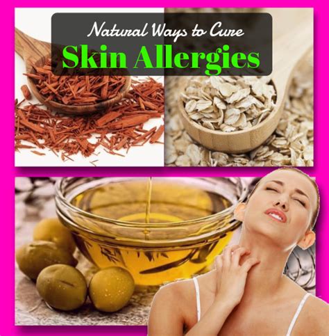 Skin Allergies Home Remedies 10 Ancient Ways To Overcome Naturally