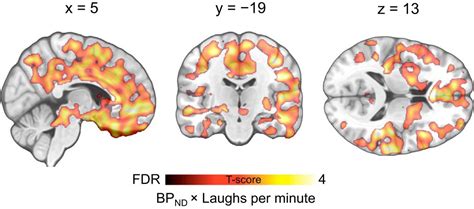 Social Laughter Triggers Endogenous Opioid Release In Humans Journal