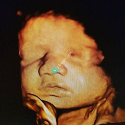 Bond With Baby Ultrasound Ankeny