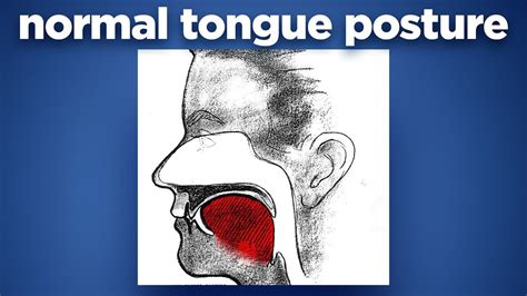 Normal Tongue Posture By Prof John Mew Youtube