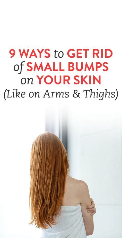 9 Ways To Get Rid Of Small Bumps On Your Skin Like On Arms And Thighs