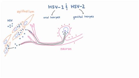 An estimated 3.7 billion people under. HSV 1 and 2 - Pathogenesis of Oral and Genital Herpes ...