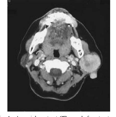 Figure 1 From The Importance Of Postoperative Radiotherapy Against