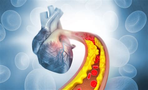 O Que é Ldl No Exame De Sangue
