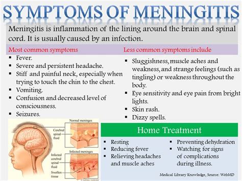 14 Best Viral Meningitis And After Effects Images On Pinterest