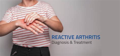 Symptoms And Treatment Of Reactive Arthritis Aster Cmi Blogs
