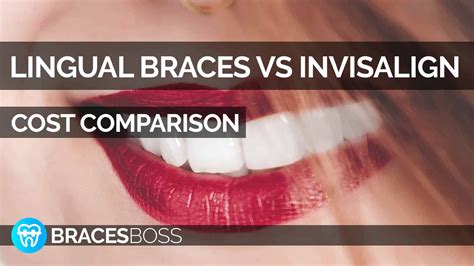 Michael ayzin dds in costa mesa, california at dentistry at its finest. Lingual Braces vs Invisalign Cost - Full Pro Guide 2020 ...