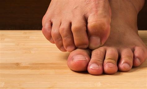 16 Can The Symptoms Of Peripheral Neuropathy In My Feet And Legs Be Reversed Peripheral