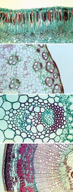 Microscope Image Of Plant Vascular Bundles Under Differential Stain B