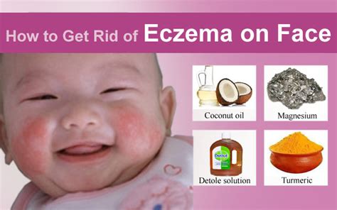 How To Get Rid Of Eczema On Face By Using Home Remedies Arbkan