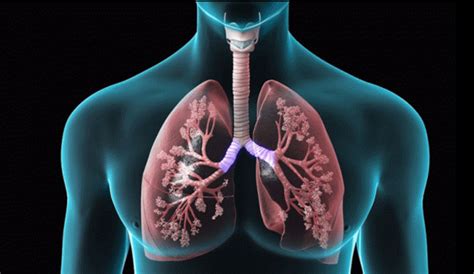What Is Chronic Obstructive Pulmonary Disease Or COPD Reiner Medical